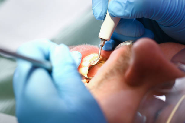 Best Chipped Tooth Repair Near Me  in Hammond, WI